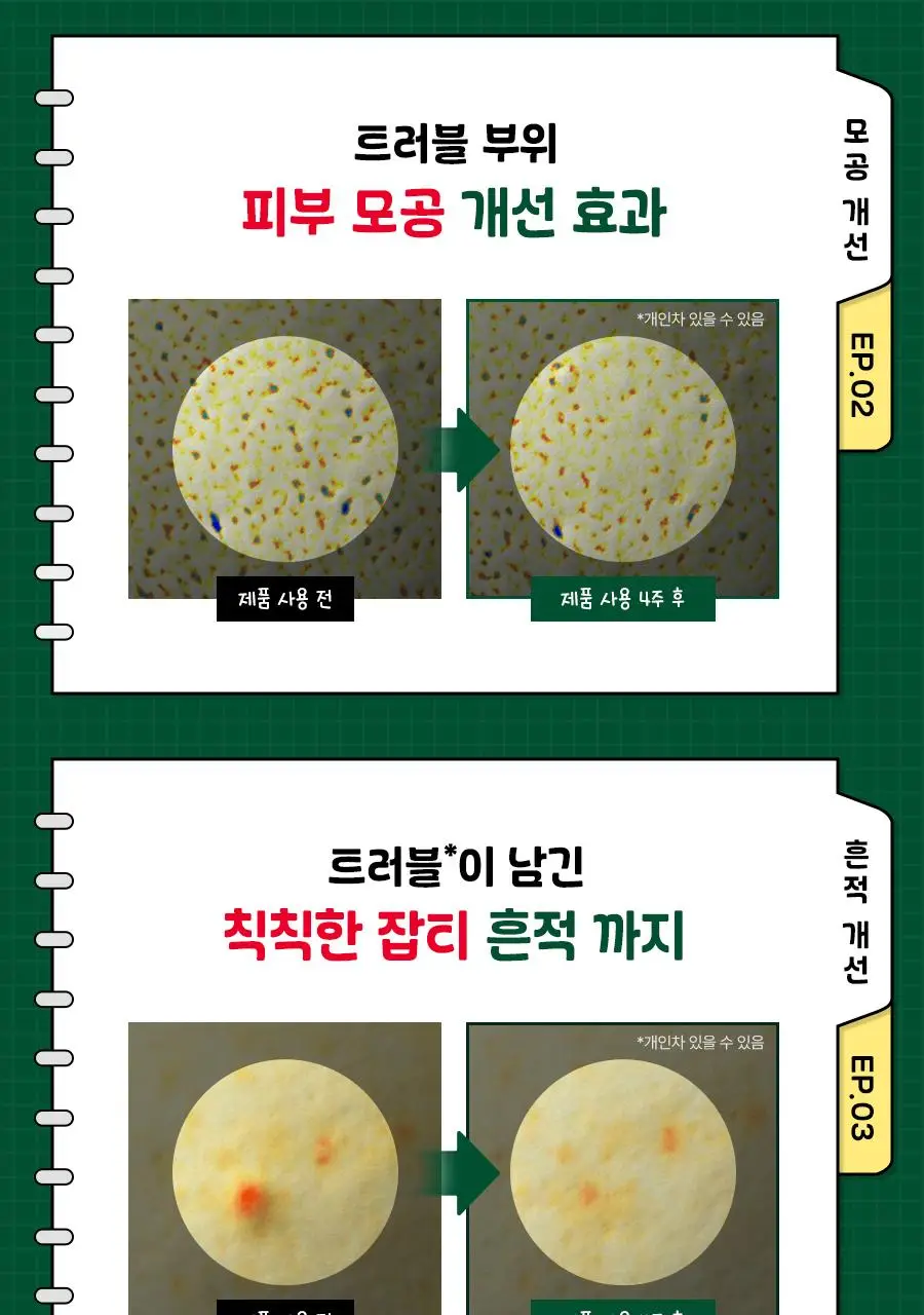 [수분진정/쫀냐미한정] 닥터지 레드 블레미쉬 클리어 히알 시카 수딩 세럼 50ml 1+1 기획(+세안밴드 증정) 상세페이지 18